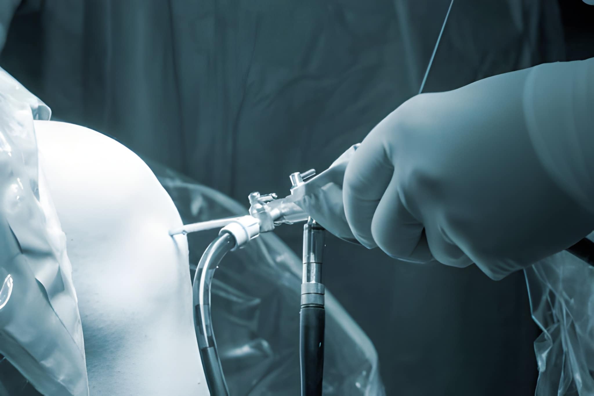 Arthroscopic Sports Surgery